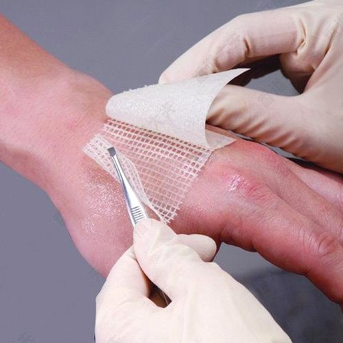 jelonet dressing how long to use Jelonet Paraffin Gauze Dressing 5cm x 5cm Pack of 5 Low-Adherent Sterile Open-Weave